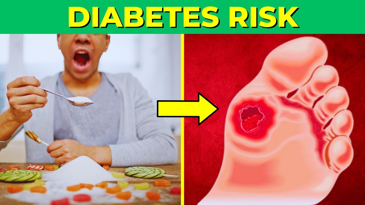 Diabetes Risk - 9 Warning Signs You Shouldn't Ignore - YouTube