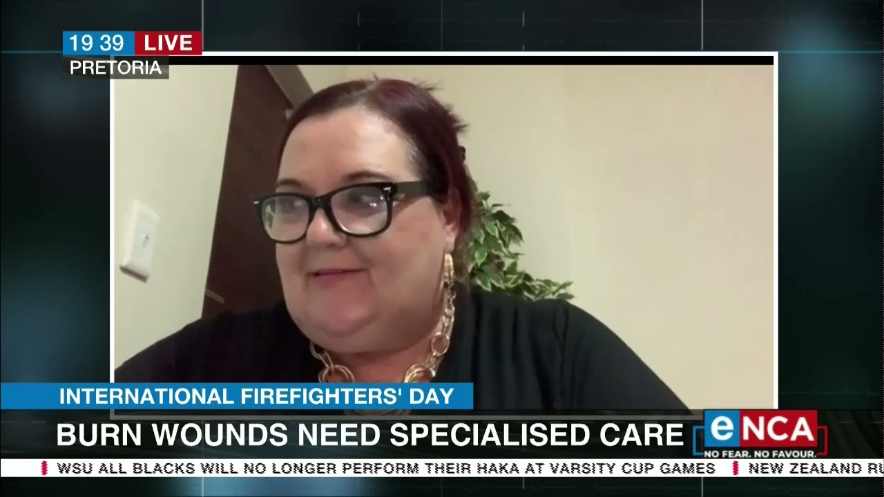 Burn victim caregivers in the spotlight this International Firefighters