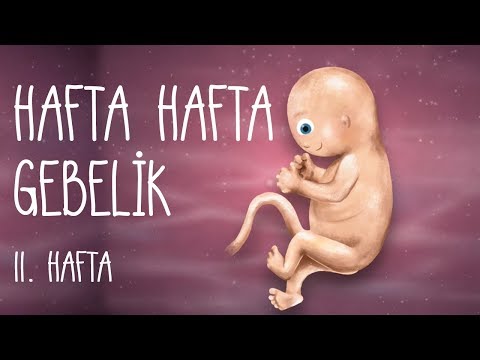 Video: Çınlayan Kulaklardan Kurtulmanın 3 Yolu