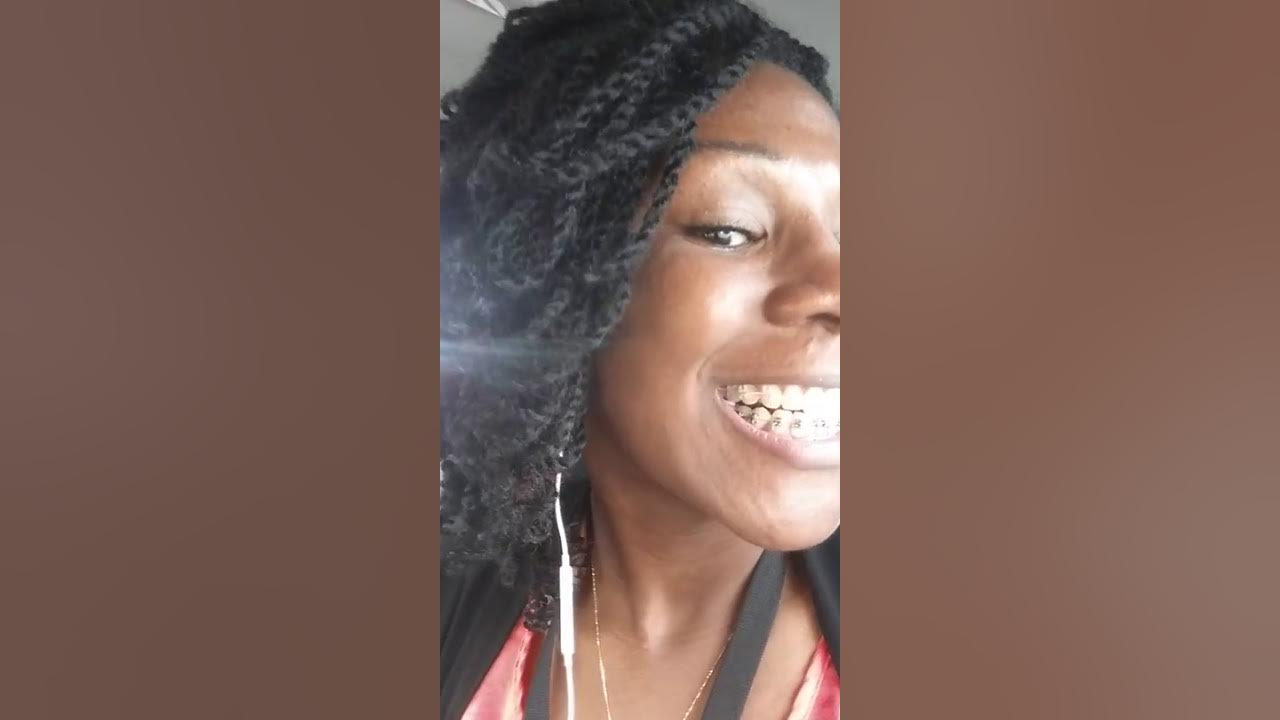 Bottom Braces with Overbite and Bite Block/Turbos Bonding YouTube