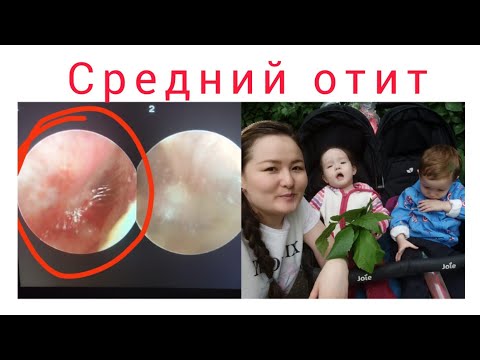 Енді ҚҰЛАҚ 👂 ауырды 🤦🏼‍♀️// Күнде думан, күнде той 😁