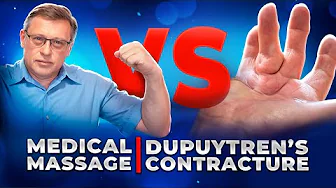 How to Treat Dupuytren's Contracture at Home? | Homework For Patience