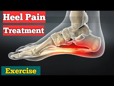 Plantar Fasciitis Treatment | Heel Spur Treatment | Heel Pain Home Exercises