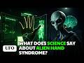 The Terrifying Truth Behind Alien Hand Syndrome | Did You Know?