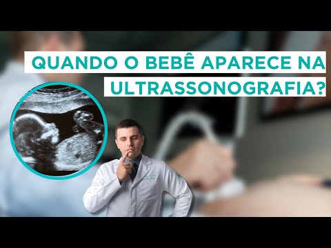 Vídeo: Em um ultrassom de bebê?