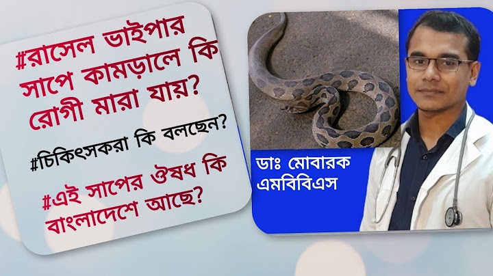 রাসেল ভাইপার সাপ কতটা বিষাক্ত।রাসেল ভাইপার সাপ  কামড় দিলে কি মানুষ সাথে সাথে মারা যায়?#russellviper