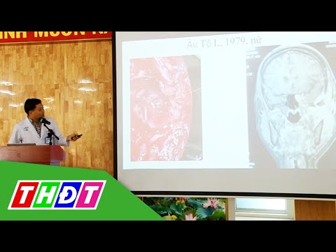 Video 2 ca hoại tử xương hàm đã t.ử v.o.n.g tại Bệnh viện... - youtube