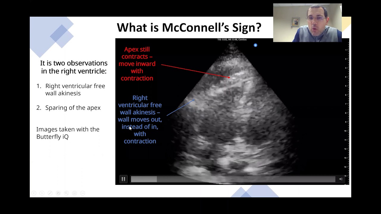 McConnell's Sign - YouTube