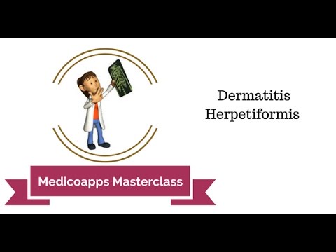 Video: Dermatitis Herpetiformis: Årsaker, Symptomer Og Diagnose