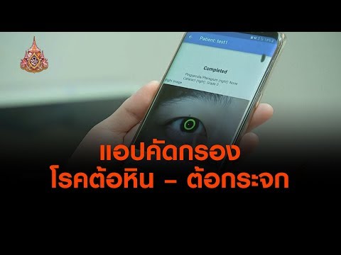 แอปคัดกรองโรคต้อหิน – ต้อกระจก : ประเด็นทางสังคม (7 พ.ค. 62)