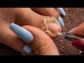 Wow, Super Thick Onychomycosis Requires Careful Trimming! #toenails  #8