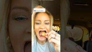 Exposed! She Put Metal Teeth Behind Her Fake Teeth 😱🦷