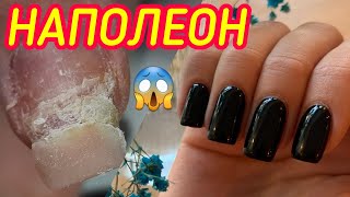 Ноготь НАПОЛЕОН - бывает и такое🤢 / Наращивание, покрытие гель лаком/ Невероятный глянец.💣