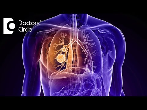 How long does it take for a blood clot in the lung to dissolve? - Dr. Shivaraj A L