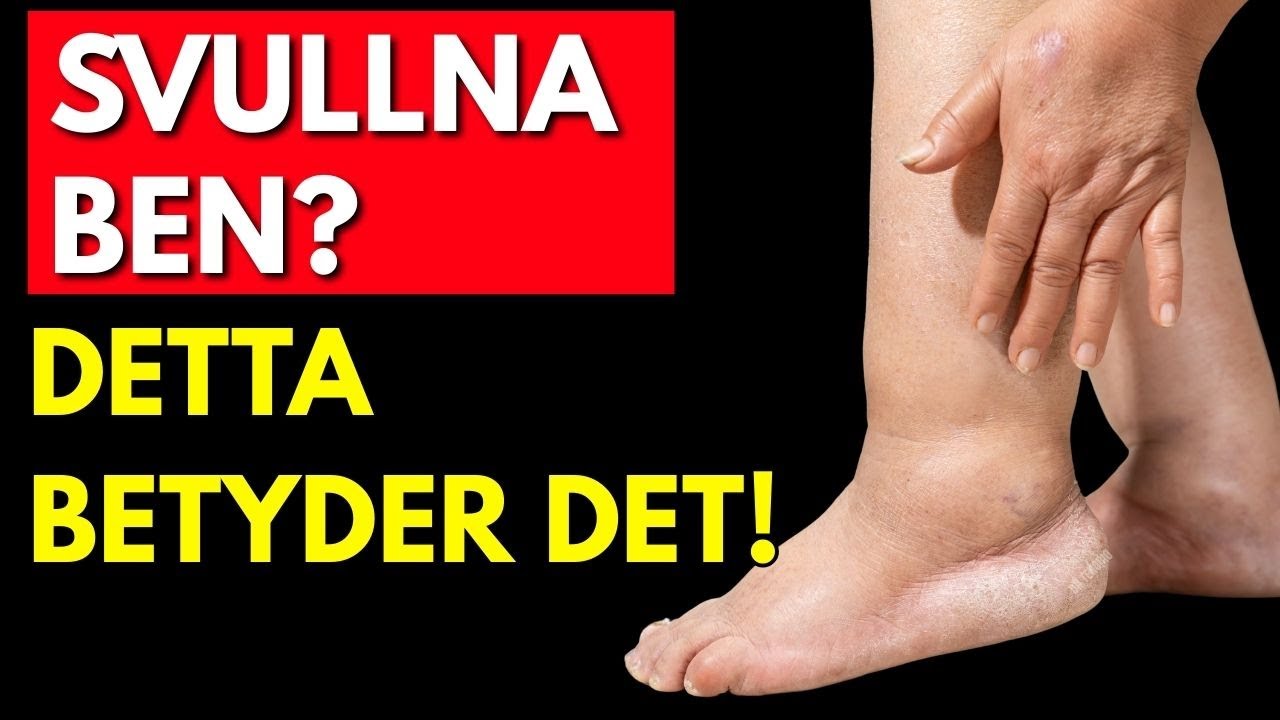 SVULLNA BEN: Signalen som din KROPP skriker till dig