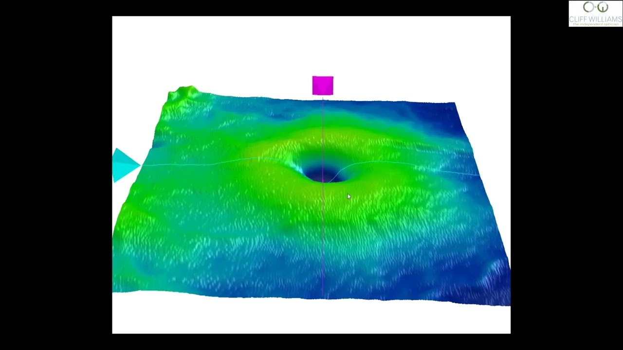 Pathfinder by ZEISS - unlocking the power of AI inOCT workflow at Cliff Williams in Kirkcaldy