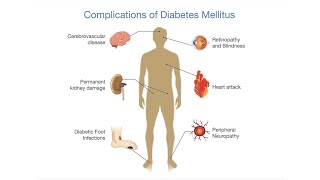 Do You Have Diabetes? 8.5 Million Americans Don't Know. Get Tested!