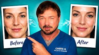 Erase 10 Years Of Facial Lines And Wrinkles In 60 Seconds
