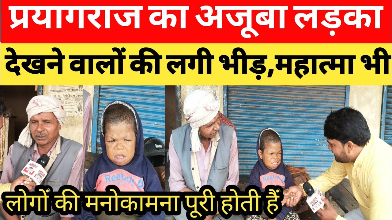 प्रयागराज: 27 वर्ष के लड़के का 94 दांत का अजीबोगरीब कारनामा लोग आशीर्वाद के लिए दूर-दूर से आ रहे हैं