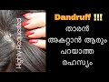 How to treat dandruff