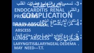 اللواز الصديدي د.فهيد السبيعي   PERITONSILLAR  ABSCESS DR. FOHEID ALSOBEI