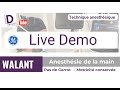 Live demo walant par les dr  sbloc et fle sach