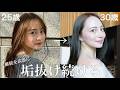 【最新版】垢抜けた理由20選✨やってよかった美容医療＆自宅美容を全部紹介！