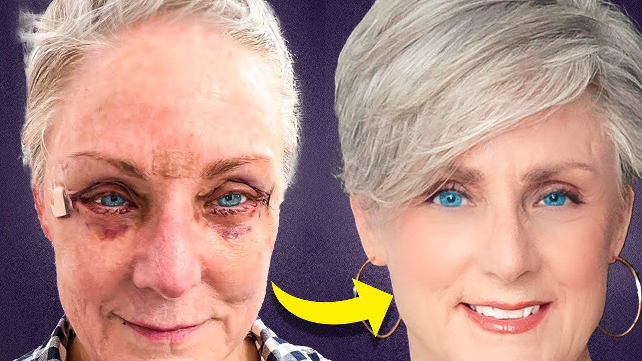 Is Cosmetic Surgery or Cosmetic Procedures the Best Way to Turn Back