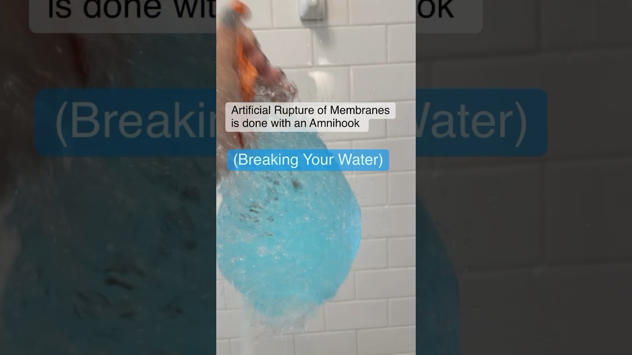 How Do They Break Your Water In Labor laboranddelivery YouTube How Do They Break Your Water In Labor laboranddelivery YouTube
