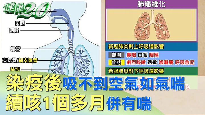 染疫后吸不到空气如气喘 续咳1个多月并有喘 健康2.0 - 天天要闻