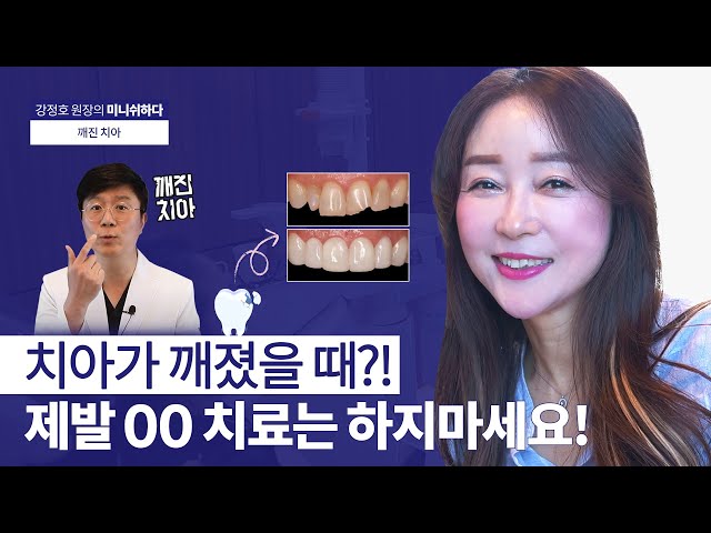 깨진 치아 손상에 따라 달라지는 치과 치료ㅣ미니쉬, 크라운, 라미네이트