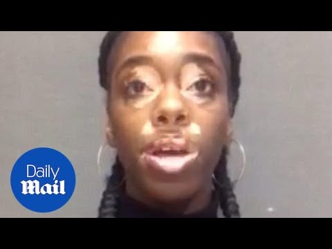 Brave model with vitiligo tells how she overcame depression