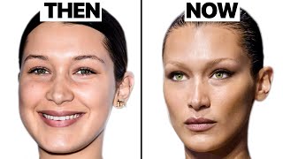 What Happened to Bella Hadid's Face? Plastic Surgeon Reacts
