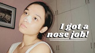 Surprise, I had rhinoplasty! (Dr. Nato Pascual of Belo Medical Group) || ReneeAlysson