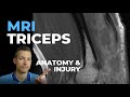 MRI Triceps Tendon Injury and Anatomy