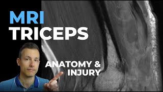 MRI Triceps Tendon Injury and Anatomy