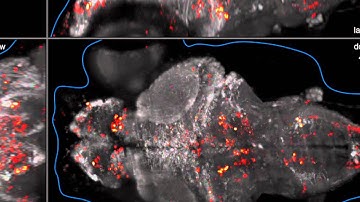 Whole-brain imaging of neuronal activity in a larval zebrafish
