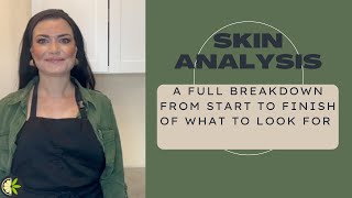 Skin Analysis a full breakdown of what I look for !