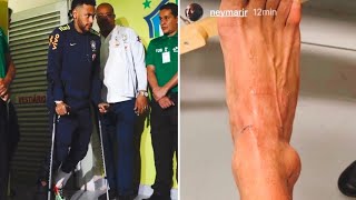 Neymar Walking With Fractured Leg