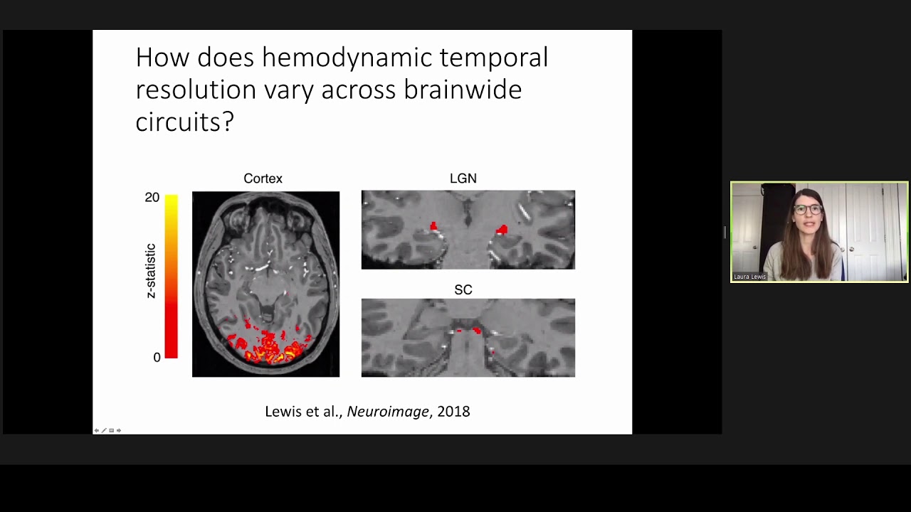 S3.GB.P01 L.Lewis Potential Limits on Hemodynamic Imaging