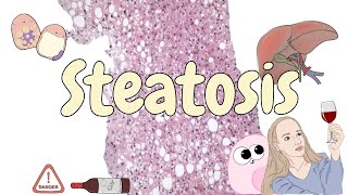 Steatosis - liver pathology