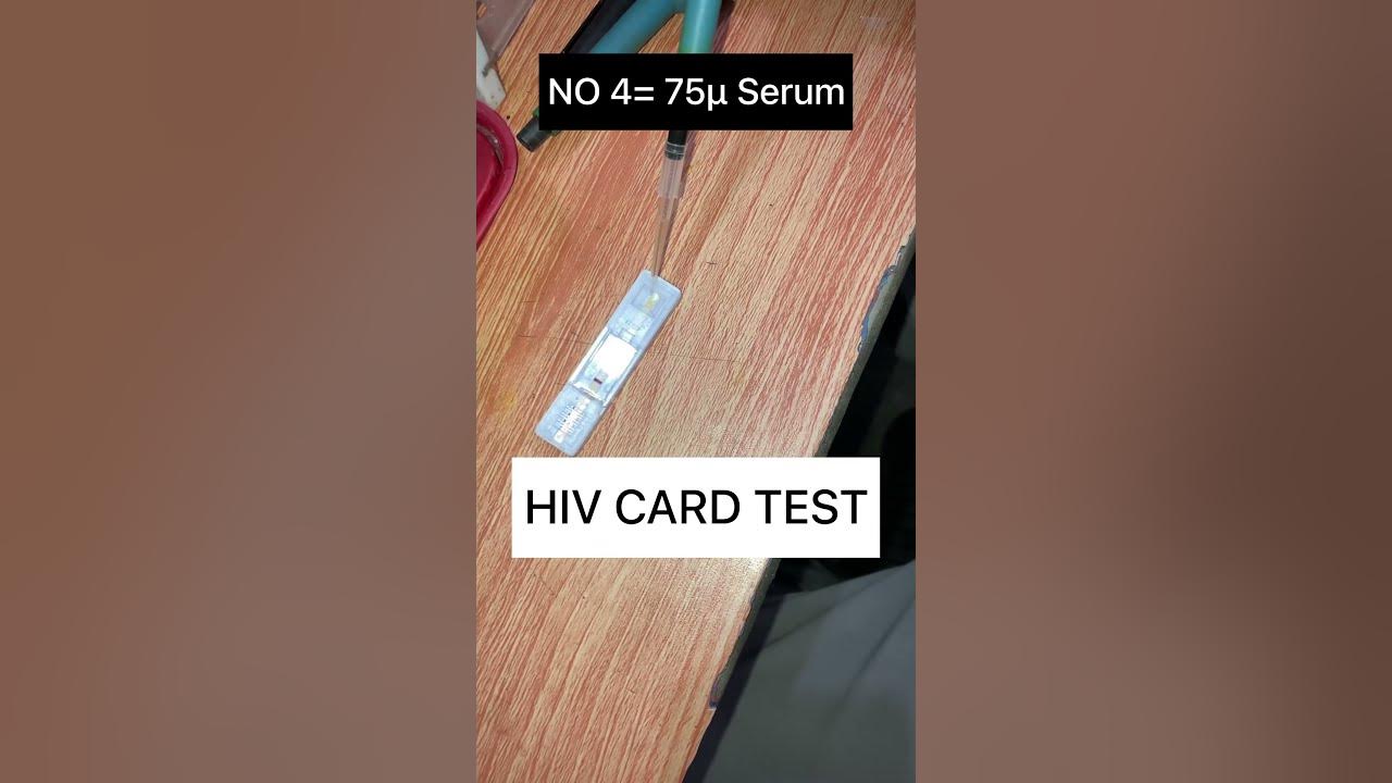 hiv-card-test-hiv-view-laboratory-viral-test-youtube
