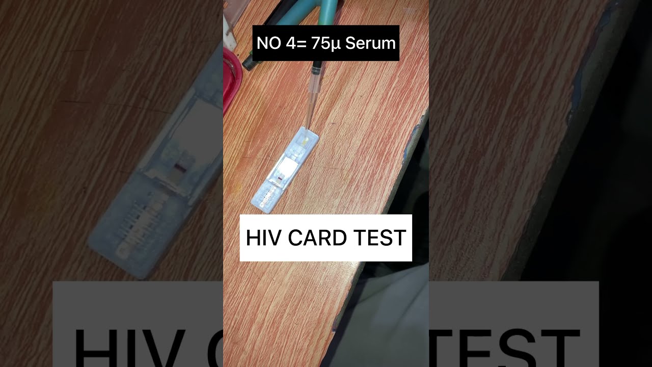 HIV CARD TEST hiv view laboratory viral test YouTube HIV CARD TEST hiv view laboratory viral test YouTube
