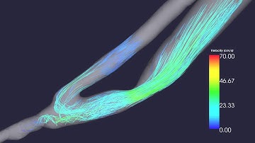 Blood flow streakline animation