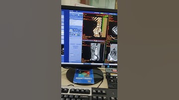 ct scan cect kub with 3D