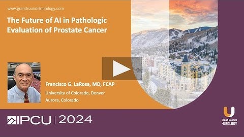 The Future of AI in Pathologic Evaluation of Prostate Cancer