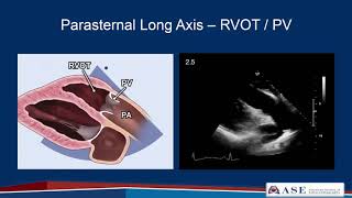 Part 2: Comprehensive TTE in Adults Webinar