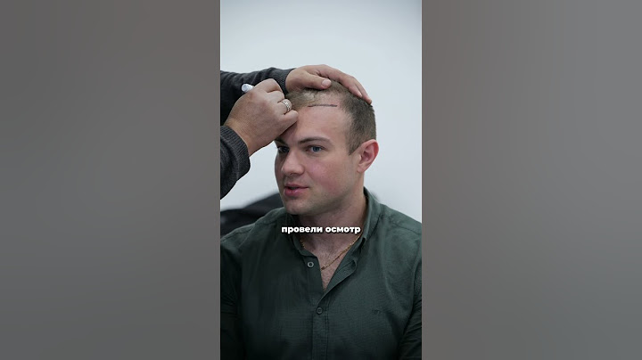 О пересадке волос