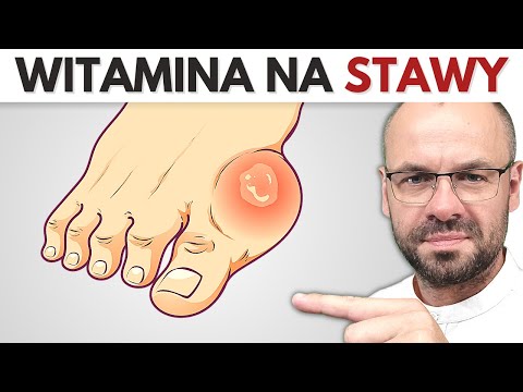 Wideo: Jak złagodzić ból stawów: czy herbata może pomóc?