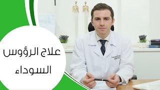 علاج الرؤوس السوداء | مع الدكتور كوستي